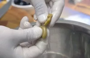 Peel the olives and chop them finely.